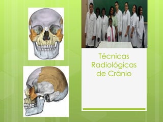 Técnicas
Radiológicas
 de Crânio
 