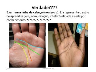 Verdade????
Examine a linha da cabeça (numero 2). Ela representa o estilo
de aprendizagem, comunicação, intelectualidade e sede por
conhecimento.?????????????????
CarlosAmade, MD4/2/2014
 