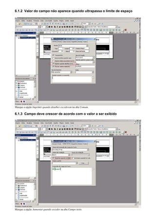 6.1.2 Valor do campo não aparece quando ultrapassa o limite de espaço




Marque a opção Imprimir quando detalhes excederem na aba Comum.

6.1.3 Campo deve crescer de acordo com o valor a ser exibido




Marque a opção Aumentar quando exceder na aba Campo texto.
 