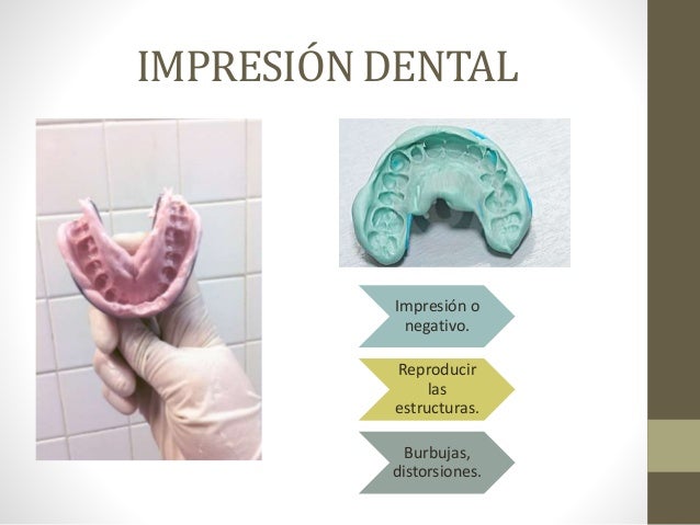 Resultado de imagen para tecnica de impresion dental