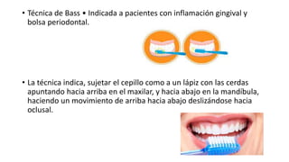 • Técnica de Bass • Indicada a pacientes con inflamación gingival y
bolsa periodontal.
• La técnica indica, sujetar el cepillo como a un lápiz con las cerdas
apuntando hacia arriba en el maxilar, y hacia abajo en la mandíbula,
haciendo un movimiento de arriba hacia abajo deslizándose hacia
oclusal.
 