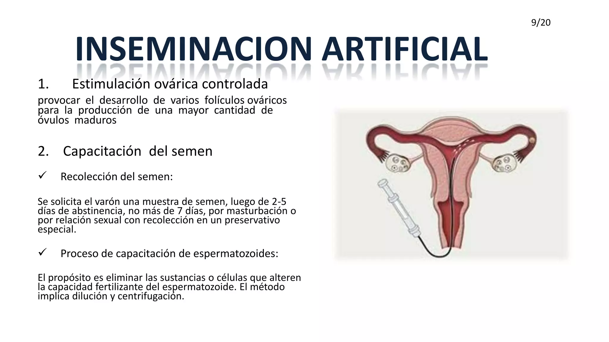 9/20


        INSEMINACION ARTIFICIAL
1.     Estimulación ovárica controlada
provocar el desarrollo de varios folículos ováricos
para la producción de una mayor cantidad de
óvulos maduros

2. Capacitación del semen
    Recolección del semen:

Se solicita el varón una muestra de semen, luego de 2-5
días de abstinencia, no más de 7 días, por masturbación o
por relación sexual con recolección en un preservativo
especial.

    Proceso de capacitación de espermatozoides:

El propósito es eliminar las sustancias o células que alteren
la capacidad fertilizante del espermatozoide. El método
implica dilución y centrifugación.
 
