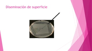 Diseminación de superficie
 