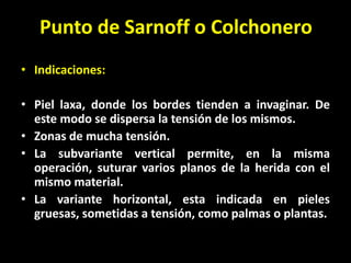 Punto de Sarnoff o Colchonero
• Indicaciones:

• Piel laxa, donde los bordes tienden a invaginar. De
  este modo se dispersa la tensión de los mismos.
• Zonas de mucha tensión.
• La subvariante vertical permite, en la misma
  operación, suturar varios planos de la herida con el
  mismo material.
• La variante horizontal, esta indicada en pieles
  gruesas, sometidas a tensión, como palmas o plantas.
 