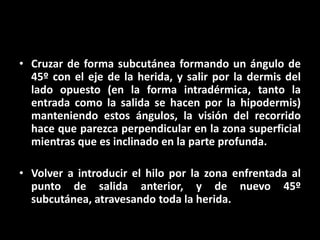 • Cruzar de forma subcutánea formando un ángulo de
  45º con el eje de la herida, y salir por la dermis del
  lado opuesto (en la forma intradérmica, tanto la
  entrada como la salida se hacen por la hipodermis)
  manteniendo estos ángulos, la visión del recorrido
  hace que parezca perpendicular en la zona superficial
  mientras que es inclinado en la parte profunda.

• Volver a introducir el hilo por la zona enfrentada al
  punto de salida anterior, y de nuevo 45º
  subcutánea, atravesando toda la herida.
 