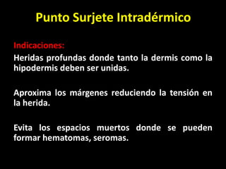Punto Surjete Intradérmico
Indicaciones:
Heridas profundas donde tanto la dermis como la
hipodermis deben ser unidas.

Aproxima los márgenes reduciendo la tensión en
la herida.

Evita los espacios muertos donde se pueden
formar hematomas, seromas.
 