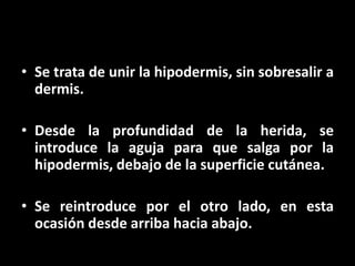 • Se trata de unir la hipodermis, sin sobresalir a
  dermis.

• Desde la profundidad de la herida, se
  introduce la aguja para que salga por la
  hipodermis, debajo de la superficie cutánea.

• Se reintroduce por el otro lado, en esta
  ocasión desde arriba hacia abajo.
 