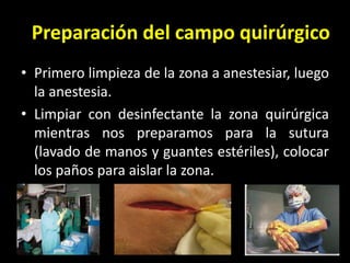 Preparación del campo quirúrgico
• Primero limpieza de la zona a anestesiar, luego
  la anestesia.
• Limpiar con desinfectante la zona quirúrgica
  mientras nos preparamos para la sutura
  (lavado de manos y guantes estériles), colocar
  los paños para aislar la zona.
 