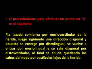 • El procedimiento para efectuar un punto en "X"
  es el siguiente:

*la lazada comienza por mesiovestibular de la
herida, luego siguiendo una dirección diagonal y
opuesta se emerge por distolingual, se vuelve a
entrar por mesiolingual y se sale diagonal por
distovestibular, al final se anuda quedando los
cabos del nudo por vestibular lejos de la herida.
 