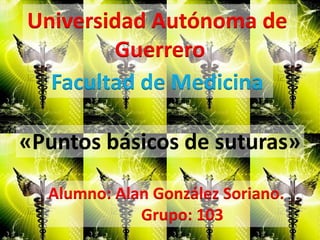 Universidad Autónoma de
        Guerrero
  Facultad de Medicina

«Puntos básicos de suturas»

  Alumno: Alan González Soriano.
             Grupo: 103
 