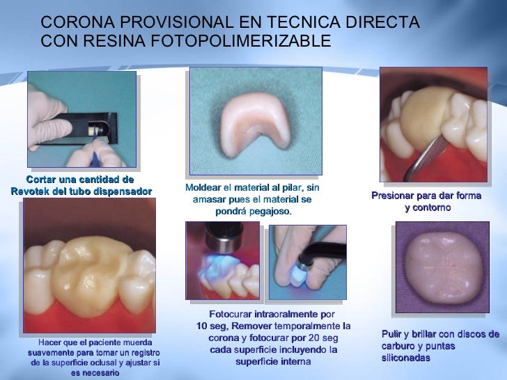 Tecnicas De Temporalizacion Y Restauraciones Provisionales