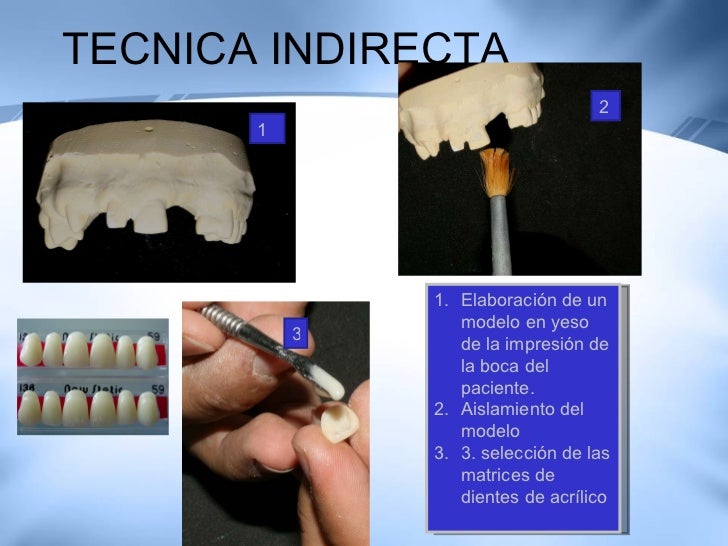 Tecnicas De Temporalizacion Y Restauraciones Provisionales