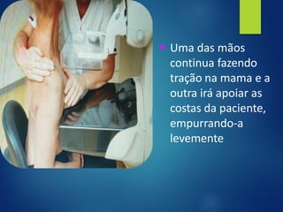 ▪ Uma das mãos
continua fazendo
tração na mama e a
outra irá apoiar as
costas da paciente,
empurrando-a
levemente
 