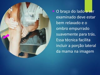 ▪ O braço do lado a ser
examinado deve estar
bem relaxado e o
ombro empurrado
suavemente para trás.
Essa técnica facilita
incluir a porção lateral
da mama na imagem
 