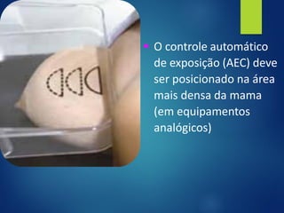 ▪ O controle automático
de exposição (AEC) deve
ser posicionado na área
mais densa da mama
(em equipamentos
analógicos)
 