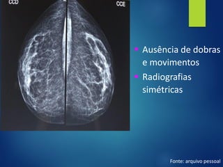 ▪ Ausência de dobras
e movimentos
▪ Radiografias
simétricas
Fonte: arquivo pessoal
 