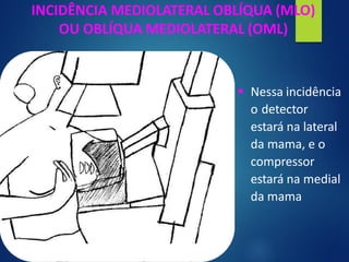 INCIDÊNCIA MEDIOLATERAL OBLÍQUA (MLO)
OU OBLÍQUA MEDIOLATERAL (OML)
▪ Nessa incidência
o detector
estará na lateral
da mama, e o
compressor
estará na medial
da mama
 