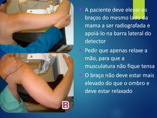 ▪ A paciente deve elevar os
braços do mesmo lado da
mama a ser radiografada e
apoiá-lo na barra lateral do
detector
▪ Pedir que apenas relaxe a
mão, para que a
musculatura não fique tensa
▪ O braço não deve estar mais
elevado do que o ombro e
deve estar relaxado
 