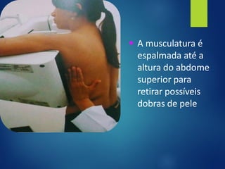 ▪ A musculatura é
espalmada até a
altura do abdome
superior para
retirar possíveis
dobras de pele
 