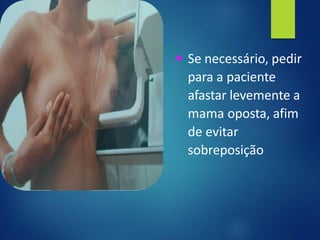 ▪ Se necessário, pedir
para a paciente
afastar levemente a
mama oposta, afim
de evitar
sobreposição
 