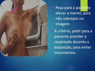 ▪ Peça para a paciente
elevar o mento, para
não sobrepor na
imagem
▪ A critério, pedir para a
paciente prender a
respiração durante a
exposição, para evitar
movimentos
 
