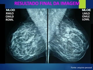 RESULTADO FINAL DA IMAGEM
RMLO
OMLD
ROML
Fonte: arquivo pessoal
LMLO
OMLE
LOML
 