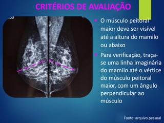 CRITÉRIOS DE AVALIAÇÃO
▪ O músculo peitoral
maior deve ser visível
até a altura do mamilo
ou abaixo
▪ Para verificação, traça-
se uma linha imaginária
do mamilo até o vértice
do músculo peitoral
maior, com um ângulo
perpendicular ao
músculo
Fonte: arquivo pessoal
 