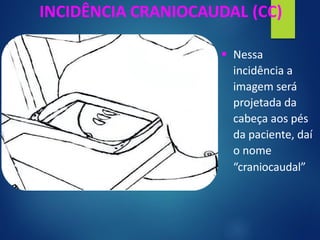 INCIDÊNCIA CRANIOCAUDAL (CC)
▪ Nessa
incidência a
imagem será
projetada da
cabeça aos pés
da paciente, daí
o nome
“craniocaudal”
 