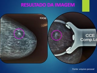 RESULTADO DA IMAGEM
Fonte: arquivo pessoal
 