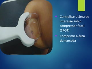 ▪ Centralizar a área de
interesse sob o
compressor focal
(SPOT)
▪ Comprimir a área
demarcada
 