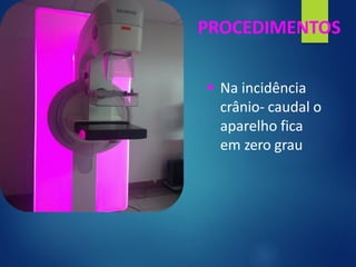 PROCEDIMENTOS
▪ Na incidência
crânio- caudal o
aparelho fica
em zero grau
 