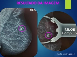 RESULTADO DA IMAGEM
Fonte: arquivo pessoal
 