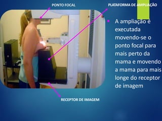 PONTO FOCAL PLATAFORMA DE AMPLIAÇÃO
▪ A ampliação é
executada
movendo-se o
ponto focal para
mais perto da
mama e movendo
a mama para mais
longe do receptor
de imagem
RECEPTOR DE IMAGEM
 