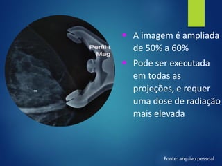 ▪ A imagem é ampliada
de 50% a 60%
▪ Pode ser executada
em todas as
projeções, e requer
uma dose de radiação
mais elevada
Fonte: arquivo pessoal
 