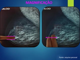 MAGNIFICAÇÃO
Fonte: arquivo pessoal
 