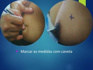 ▪ Marcar as medidas com caneta
 