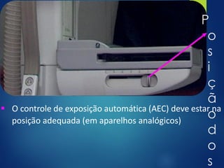 P
o
s
i
ç
ã
o
d
o
s
▪ O controle de exposição automática (AEC) deve estar na
posição adequada (em aparelhos analógicos)
 
