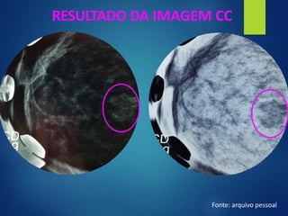 RESULTADO DA IMAGEM CC
Fonte: arquivo pessoal
 