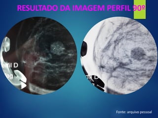 RESULTADO DA IMAGEM PERFIL 90º
Fonte: arquivo pessoal
 