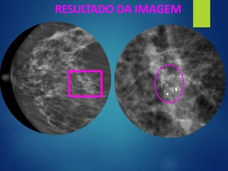 RESULTADO DA IMAGEM
 