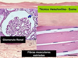 Lic. SUSI DAVOLIO- Cátedra
Histología- FM
Glomerulo Renal
Fibras musculares
estriadas
Técnica Hematoxilina- Eosina
 