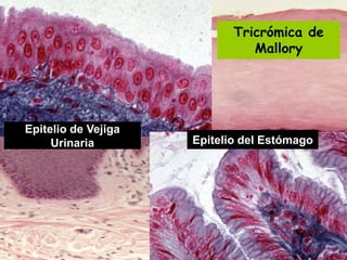 Lic. SUSI DAVOLIO- Cátedra
Histología- FM
Epitelio de Vejiga
Urinaria Epitelio del Estómago
Tricrómica de
Mallory
 