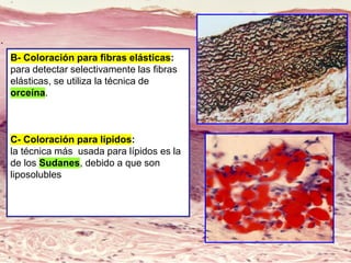 B- Coloración para fibras elásticas:
para detectar selectivamente las fibras
elásticas, se utiliza la técnica de
orceína.
C- Coloración para lípidos:
la técnica más usada para lípidos es la
de los Sudanes, debido a que son
liposolubles
 