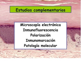 Estudios complementarios
Microscopía electrónica
Inmunofluorescencia
Polarización
Inmunomarcación
Patología molecular
 