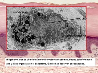 Imagen con MET de una célula donde se observa lisosomas, núcleo con cromatina
laxa y otras organelas en el citoplasma, también se observan pseudópodos.
NÚCLEO
PSEUDOPODOS
LISOSOMAS
 