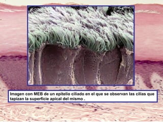 Imagen con MEB de un epitelio ciliado en el que se observan las cilias que
tapizan la superficie apical del mismo .
 