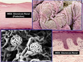 MEB: Glomérulo Renal
MEB: Glomérulo Renal
(Podocitos)
 