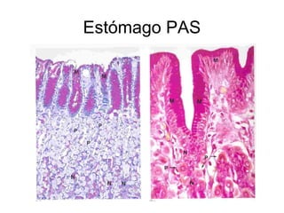 Estómago PAS