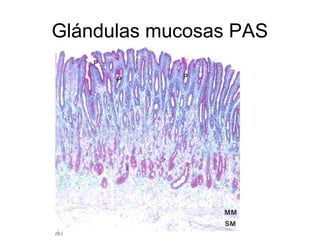 Glándulas mucosas PAS 
 
