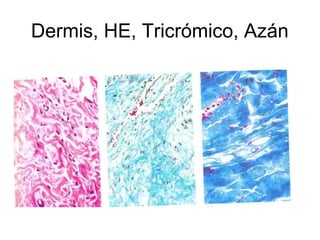 Dermis, HE, Tricrómico, Azán 
 